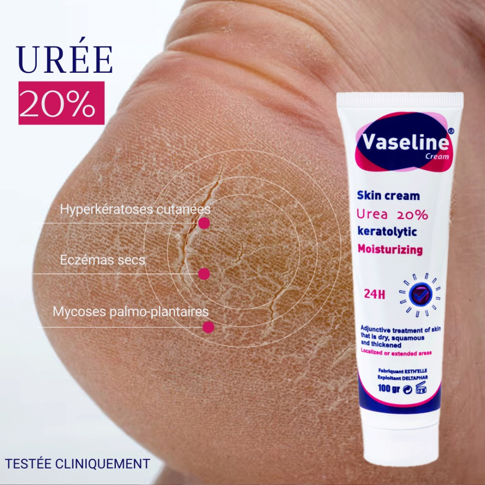 VASELINE UREE 20% TUBE 100GR
